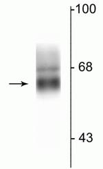 GABRA4 Antibody in Western Blot (WB)