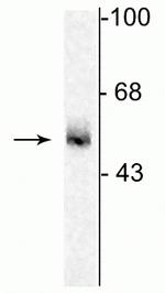 GABRA5 Antibody in Western Blot (WB)