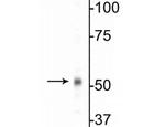 GABRB1 Polyclonal Antibody