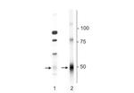 GABRD Polyclonal Antibody