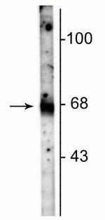 SLC6A1 Polyclonal Antibody