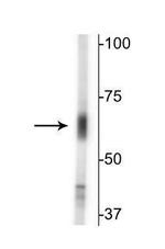 SLC6A13 Polyclonal Antibody