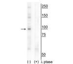 Phospho-CtIP (Thr847) Polyclonal Antibody