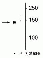 Phospho-DENND3 (Ser554) Polyclonal Antibody