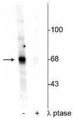 Phospho-AKT1 (Thr342) Polyclonal Antibody