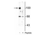 Phospho-GluR2 (Ser880) Polyclonal Antibody