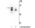 Phospho-HSP70 (Ser153) Polyclonal Antibody