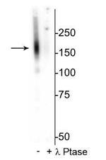 Phospho-SLC12A3 (Thr53) Polyclonal Antibody