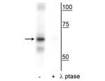 Phospho-NFkB p65 (Ser316) Antibody in Western Blot (WB)