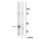 Phospho-Creatine Kinase MT (Tyr153) Polyclonal Antibody