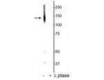 Phospho-KCC2 (Thr1007) Polyclonal Antibody