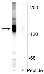 Phospho-KCC2 (Ser940) Polyclonal Antibody
