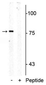 Phospho-SLC6A4 (Thr276) Polyclonal Antibody