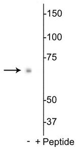 Phospho-p70 S6 Kinase (Ser398) Polyclonal Antibody