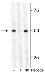 Phospho-p70 S6 Kinase (Thr449) Antibody in Western Blot (WB)