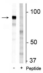 Phospho-Niban-like protein (Ser679, Ser683) Polyclonal Antibody
