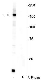 Phospho-FANCI (Ser556) Antibody in Western Blot (WB)