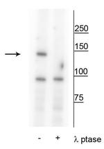 Phospho-FANCI (Ser559) Antibody in Western Blot (WB)