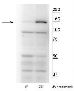 Phospho-FANCI (Ser559) Antibody in Western Blot (WB)