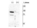 Phospho-PANK4 (Thr63) Antibody in Western Blot (WB)