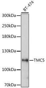 TMC5 Antibody in Western Blot (WB)