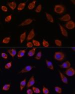 HPS4 Polyclonal Antibody