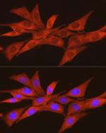 CK2 alpha-2 Polyclonal Antibody