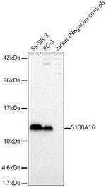S100A16 Polyclonal Antibody