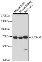 SLC34A3 Polyclonal Antibody