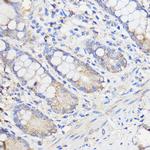 WBSCR27 Antibody in Immunohistochemistry (Paraffin) (IHC (P))