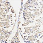 WBSCR27 Antibody in Immunohistochemistry (Paraffin) (IHC (P))
