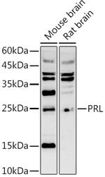 Prolactin Polyclonal Antibody