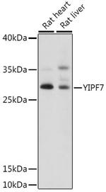 YIPF7 Polyclonal Antibody