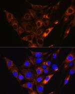 HCN1 Polyclonal Antibody
