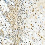 KIAA1429 Polyclonal Antibody
