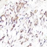 CD62L Polyclonal Antibody
