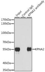 KPNA2 Antibody in Immunoprecipitation (IP)