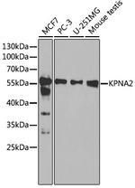 KPNA2 Antibody in Western Blot (WB)