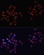 GM130 Antibody in Immunocytochemistry (ICC/IF)