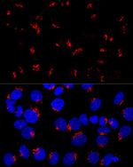GM130 Antibody in Immunocytochemistry (ICC/IF)