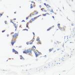 GM130 Antibody in Immunohistochemistry (Paraffin) (IHC (P))