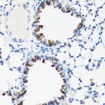 GM130 Antibody in Immunohistochemistry (Paraffin) (IHC (P))