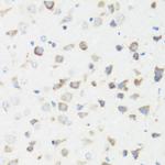 GM130 Antibody in Immunohistochemistry (Paraffin) (IHC (P))