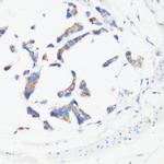 GM130 Antibody in Immunohistochemistry (Paraffin) (IHC (P))