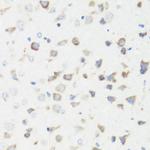 GM130 Antibody in Immunohistochemistry (Paraffin) (IHC (P))