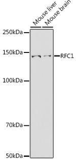 RFC1 Antibody in Western Blot (WB)