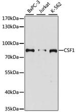 M-CSF Polyclonal Antibody