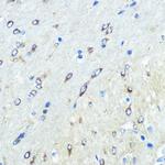 FUT4 Polyclonal Antibody