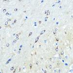 FUT4 Antibody in Immunohistochemistry (Paraffin) (IHC (P))