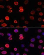 UNC84B Antibody in Immunocytochemistry (ICC/IF)